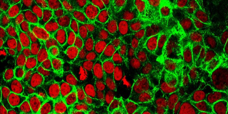 New way to overcome colorectal cancer’s resistance to immune response