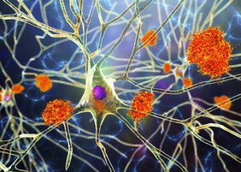 The FDA approved a new drug to treat Alzheimer’s, but Medicare won’t always pay for it – a doctor explains what researchers know about Biogen’s Aduhelm