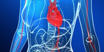 New genetic insights on common cause of heart attack in younger women