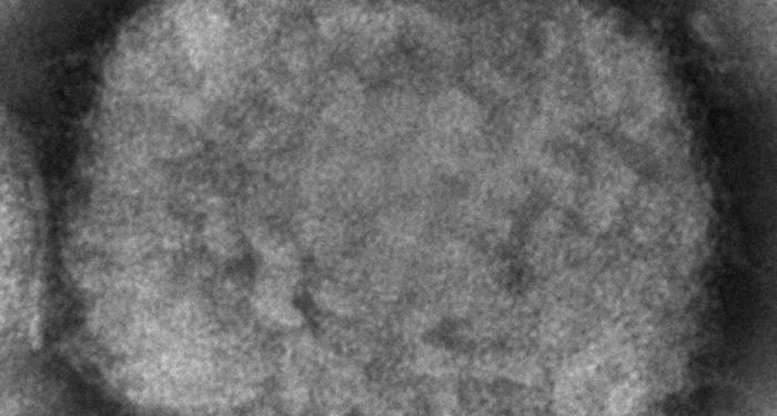 WHO says monkeypox ‘containable’