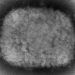 WHO says monkeypox ‘containable’