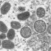 CDC warns doctors to watch for monkeypox