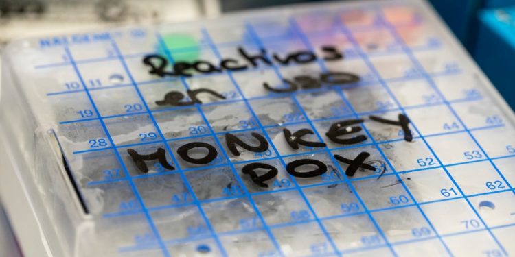 Here are ways to protect yourself and others from monkeypox