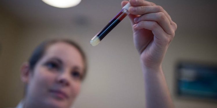 Senate Democrats call on FDA to change ‘discriminatory’ blood donor policies