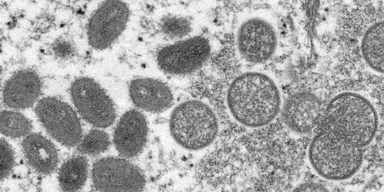 First possible monkeypox case reported in DC