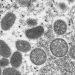 WHO: No guarantee monkeypox won’t spread beyond specific communities