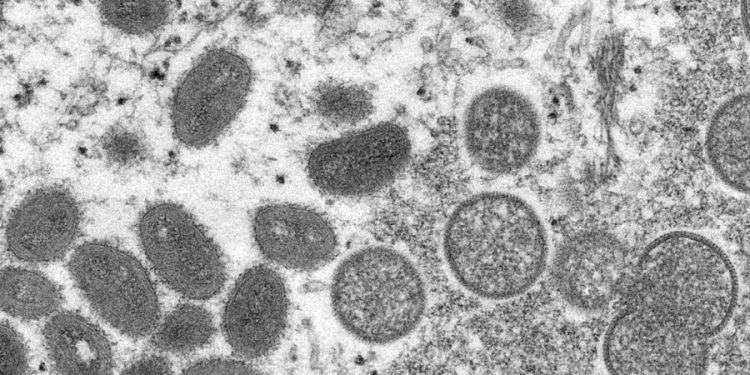 Monkeypox vaccine appointment website crashes in New York City