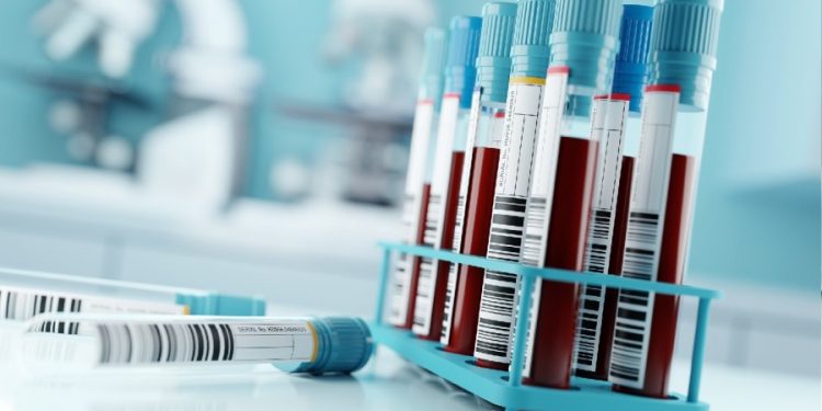 Blood tests for ‘forever chemicals’ should be offered to patients with high exposure: report