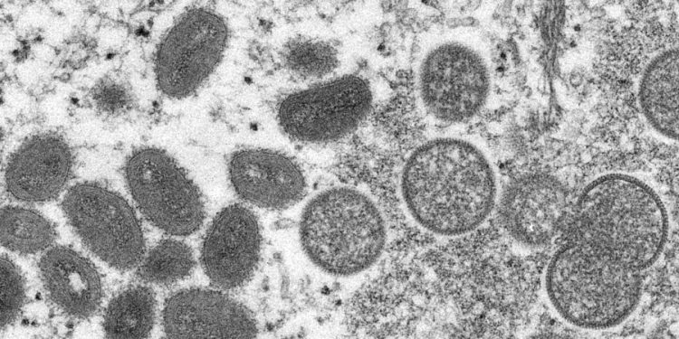 University of Maryland reports first presumptive monkeypox case