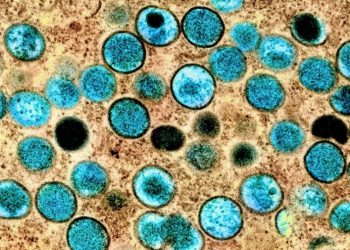 Black and Hispanic people bearing brunt of monkeypox cases: analysis