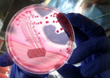 CDC investigating ‘fast-moving’ E. coli outbreak that has sickened dozens