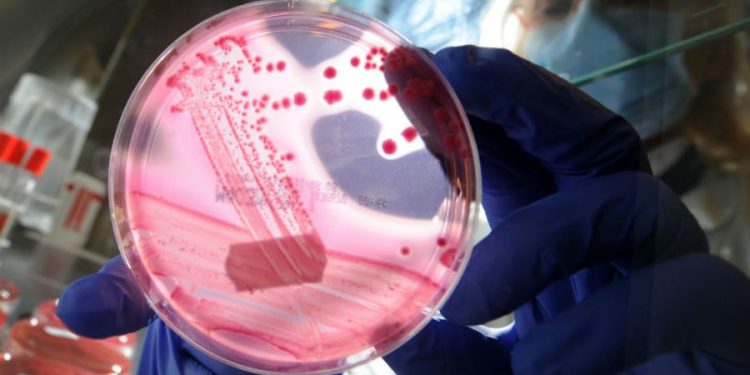 CDC investigating ‘fast-moving’ E. coli outbreak that has sickened dozens