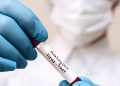 New York reports first juvenile monkeypox case