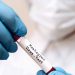 First death in US of person with monkeypox confirmed in Texas