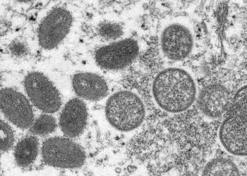 NIH launches clinical trial evaluating efficacy of TPOXX against monkeypox