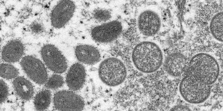 NIH launches clinical trial evaluating efficacy of TPOXX against monkeypox