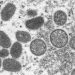 NIH launches clinical trial evaluating efficacy of TPOXX against monkeypox