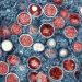 CDC has ‘moderate confidence’ that monkeypox cases will keep falling or plateau