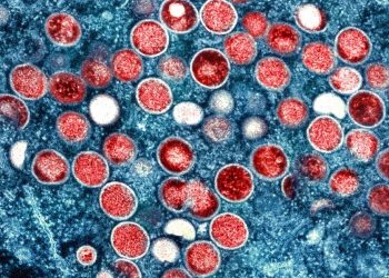 First US monkeypox death confirmed in California