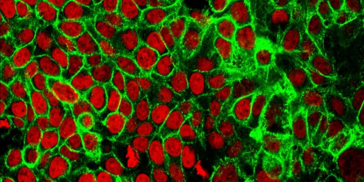 New study suggests benefits of colonoscopies may be overestimated