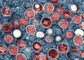 WHO renames monkeypox as ‘mpox’