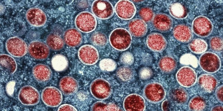 WHO renames monkeypox as ‘mpox’