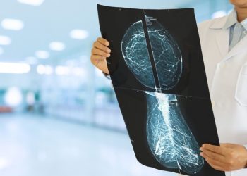 Medical tech company partners with Google to improve breast cancer screenings