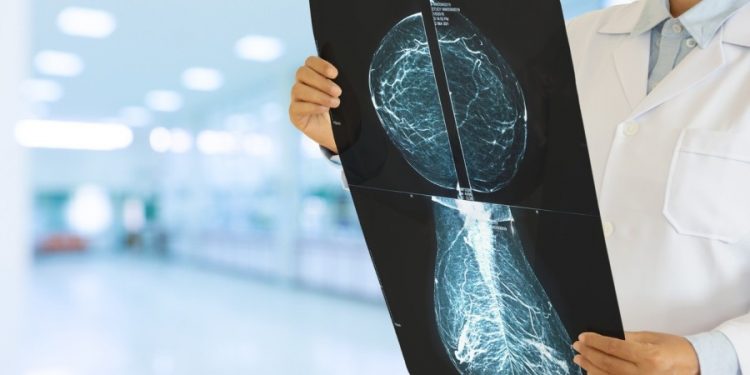 Medical tech company partners with Google to improve breast cancer screenings