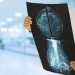 Medical tech company partners with Google to improve breast cancer screenings