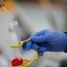 New report details pain for workers from long COVID