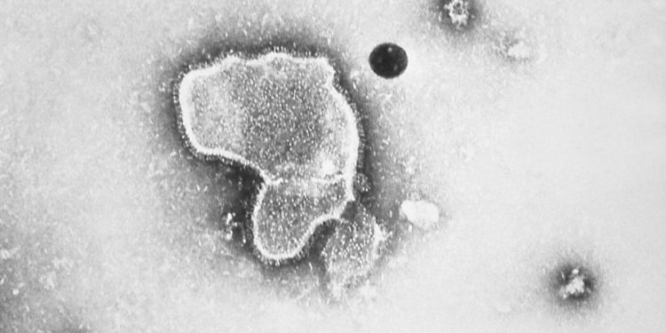 FDA panel narrowly endorses Pfizer vaccine for RSV in older adults