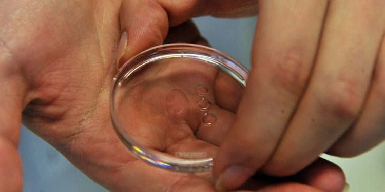 Fifth person cured of HIV after stem cell transplant, researchers say