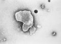 Final data shows Pfizer RSV vaccine 82 percent effective in infants when given to pregnant mothers