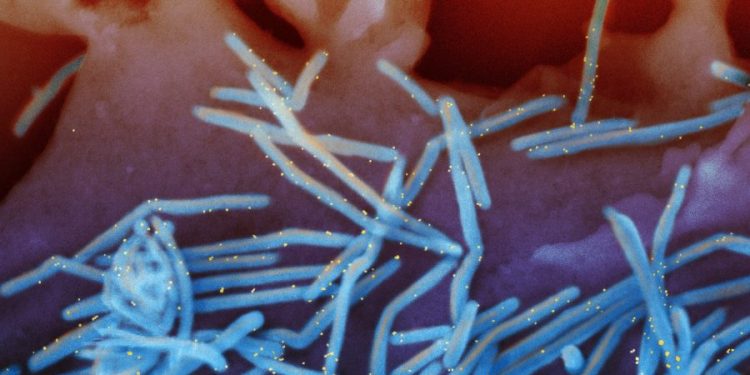 FDA advisory panel votes in favor of Pfizer RSV vaccine