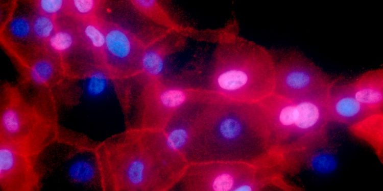 Breast cancer screenings should begin at 40, not 50, new guidelines say