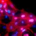 Breast cancer screenings should begin at 40, not 50, new guidelines say