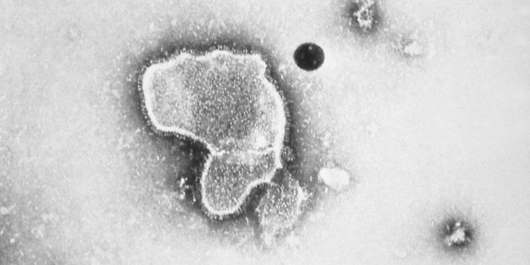 CDC recommends RSV vaccine for adults age 60 and older