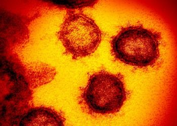 Ohio resident sought by scientists may have had ‘cryptic’ COVID strain for 2 years