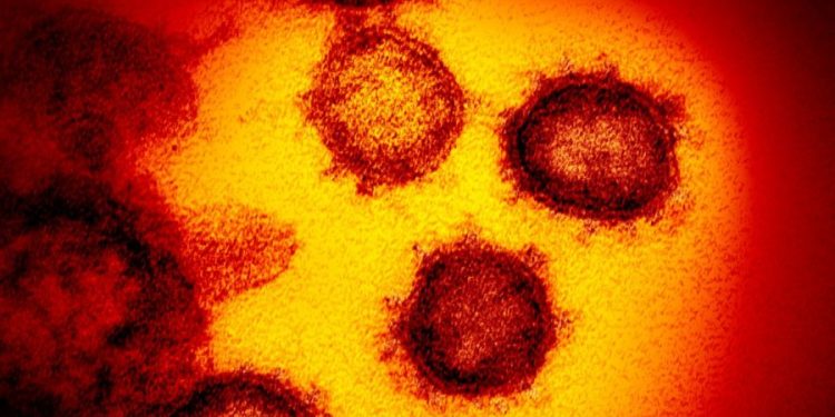 Ohio resident sought by scientists may have had ‘cryptic’ COVID strain for 2 years