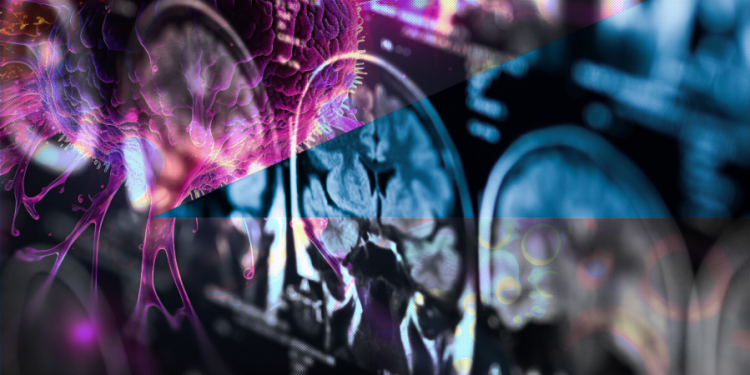 How COVID set back the fight against cancer, and why it’s only getting worse