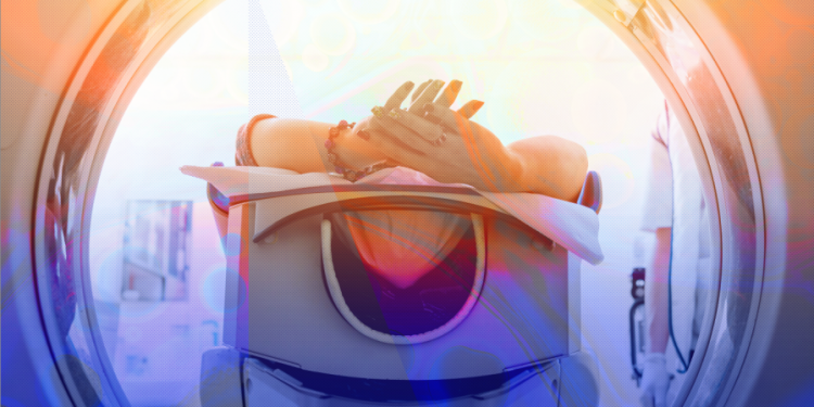 Cancer rates are climbing among young people. It’s not clear why