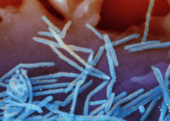 CDC panel recommends drug that prevents RSV for babies