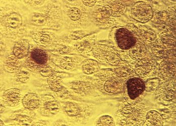 CDC proposes antibiotic as morning-after STI treatment for gay, bisexual men and transgender women