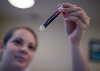 New study links ‘good’ cholesterol with dementia