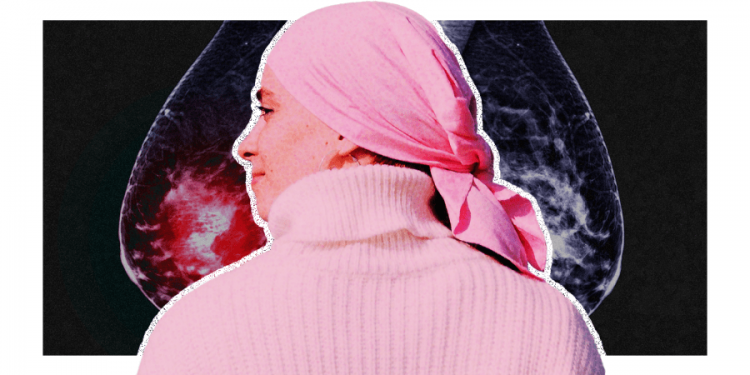 Breast cancer rates are rising. But more women are surviving too