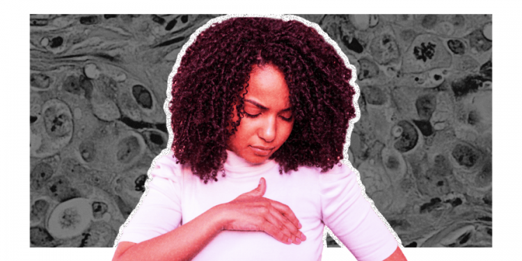 Black women face deadly racial disparities in breast cancer