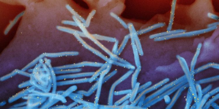 White House plans next year’s RSV immunization campaign following shortages