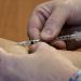 US tuberculosis cases rise for third year in a row: CDC