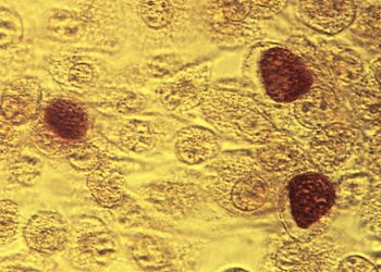 Chlamydia vaccine shows promising results in early-stage trial