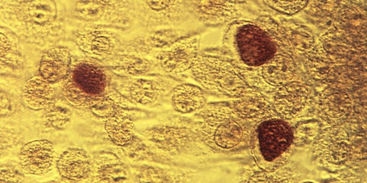 Chlamydia vaccine shows promising results in early-stage trial